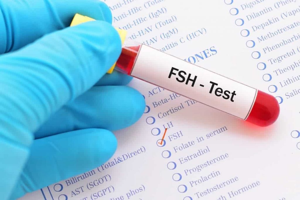 حدوث الحمل مع ارتفاع هرمون FSH